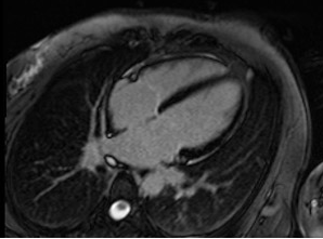 Herz/Kardio- MRT unter Ruhebedingungen